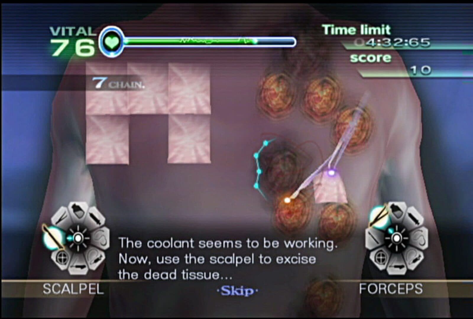 Trauma Center: New Blood screenshot 9