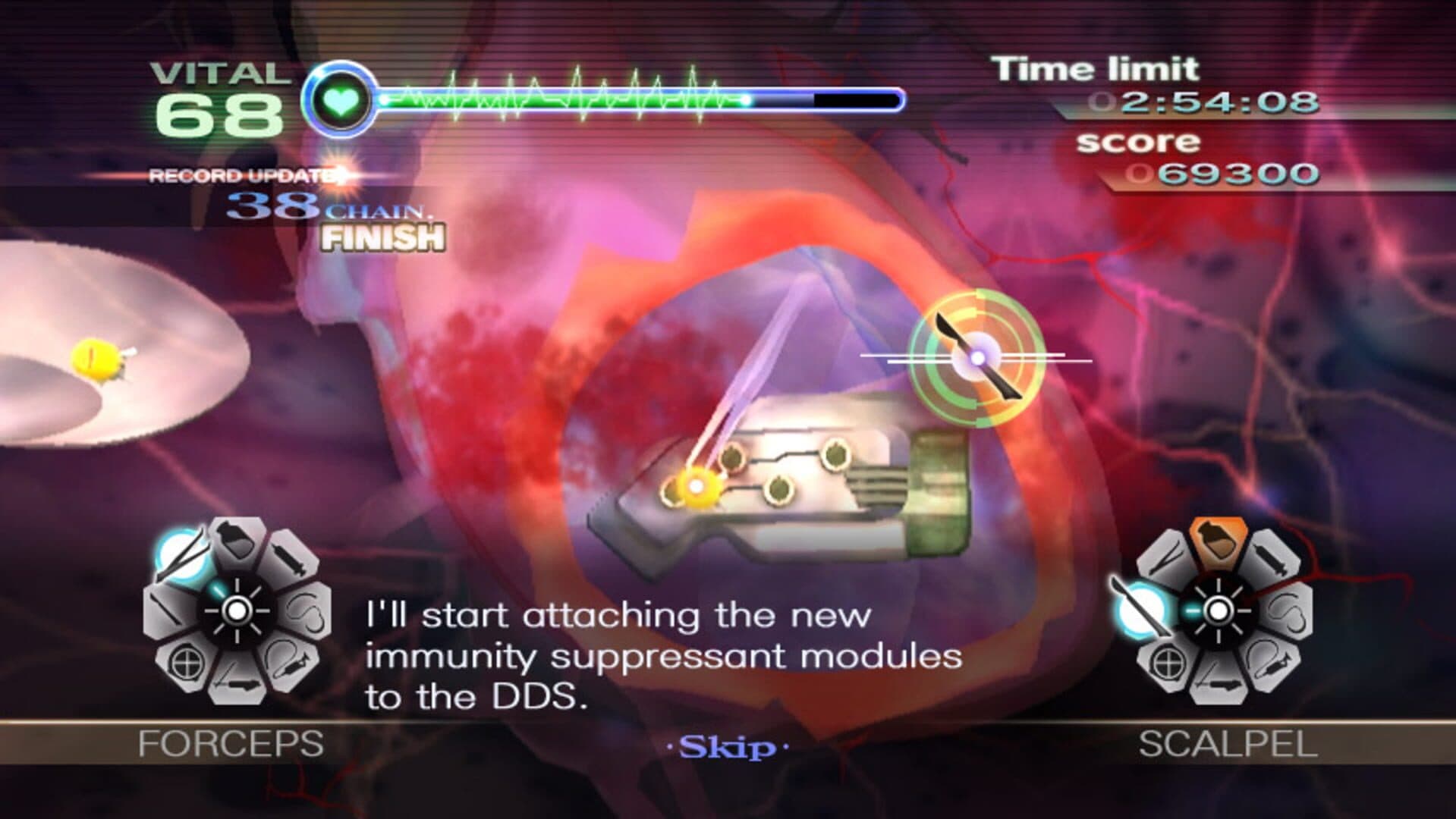 Trauma Center: New Blood screenshot 12