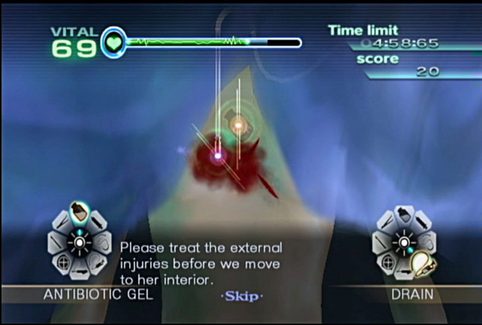 Trauma Center: New Blood screenshot 7