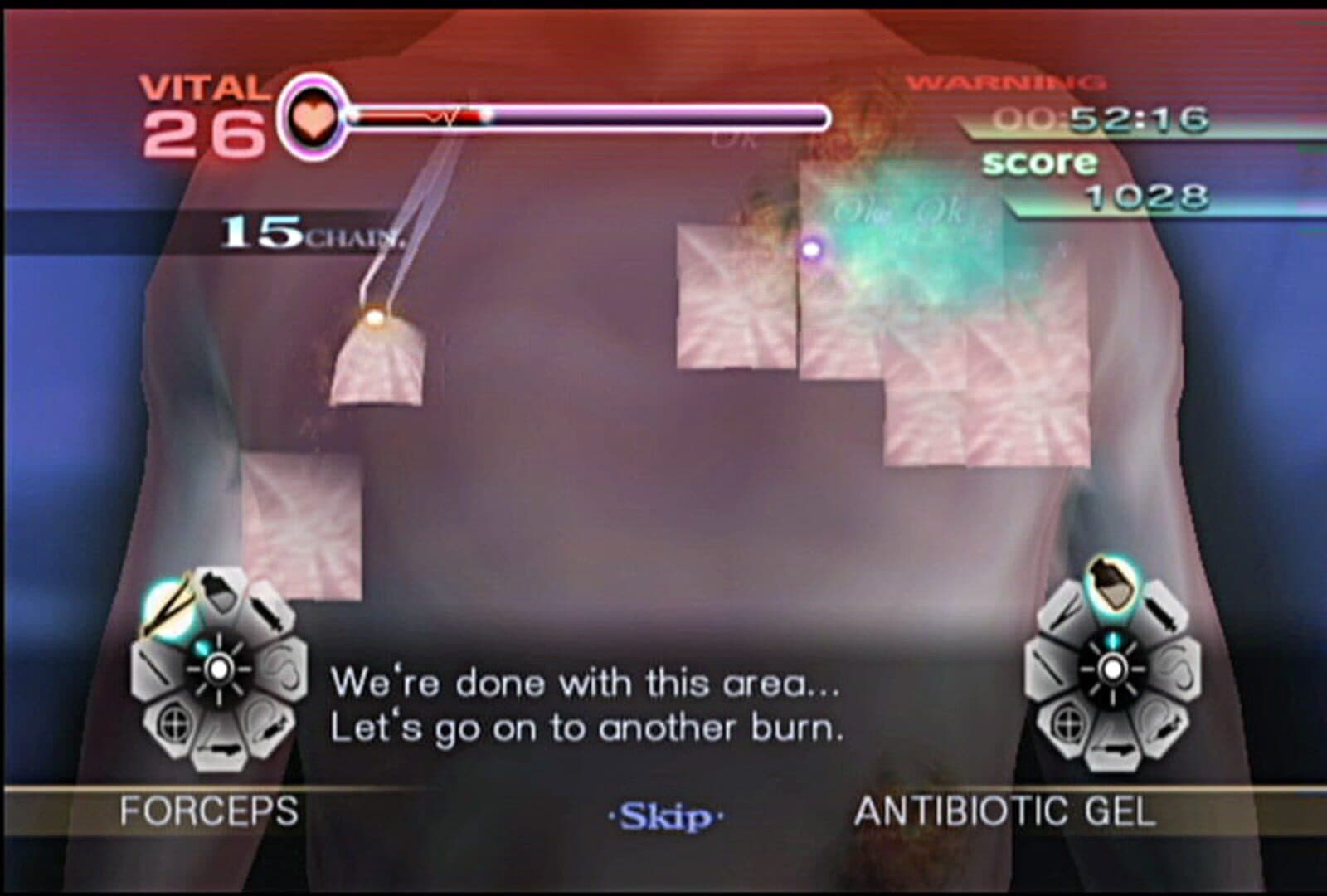 Trauma Center: New Blood screenshot 8
